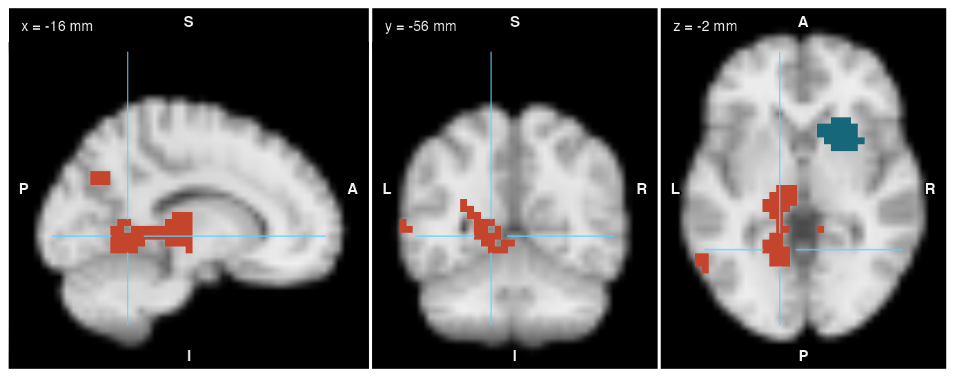 Orthogonal views through the peak of the largest cluster; cluster 1 in coral and cluster 2 in teal, matching the table