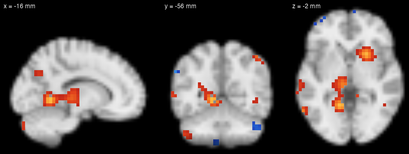 Sagittal, coronal and axial views of the MNI152 template with a thresholded simulated statistic map: positive values in red-yellow, negative in blue