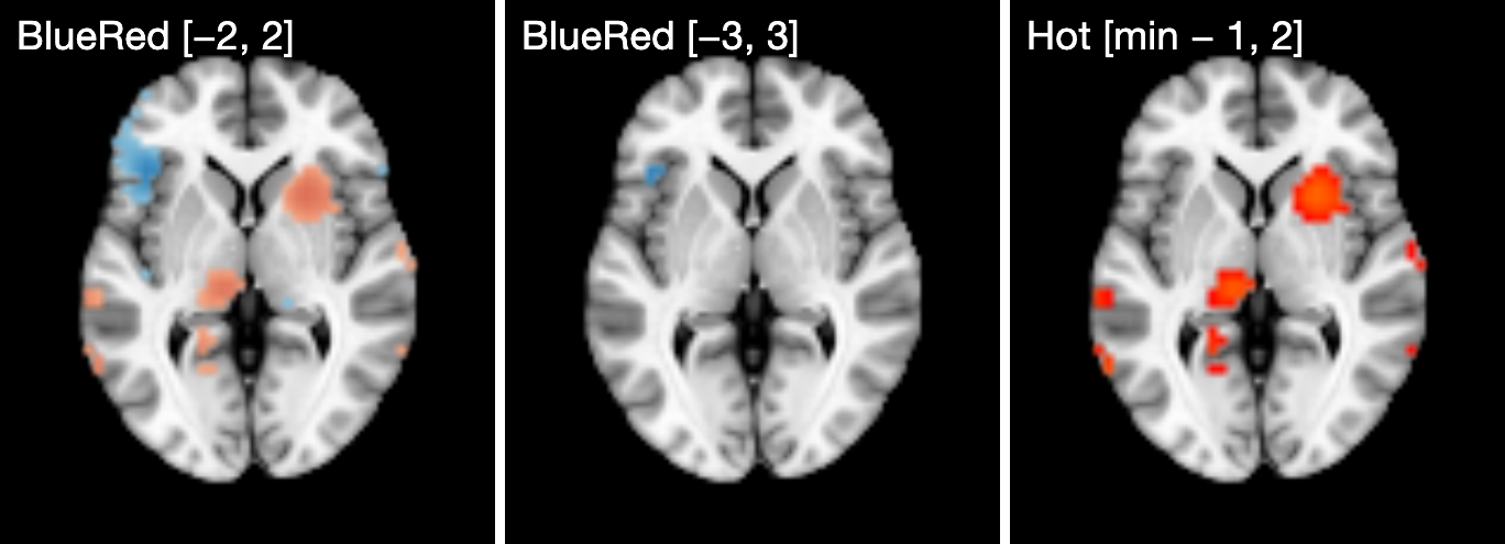 Three copies of one axial slice: the map with the BlueRed colormap at threshold minus 2 to 2, the same at minus 3 to 3 with only one small blue cluster left, and positive values only in the Hot colormap