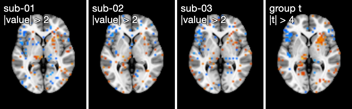 Four axial slices: three noisy single-subject maps with scattered suprathreshold voxels, and the group one-sample t map in which the clusters of the underlying map stand out